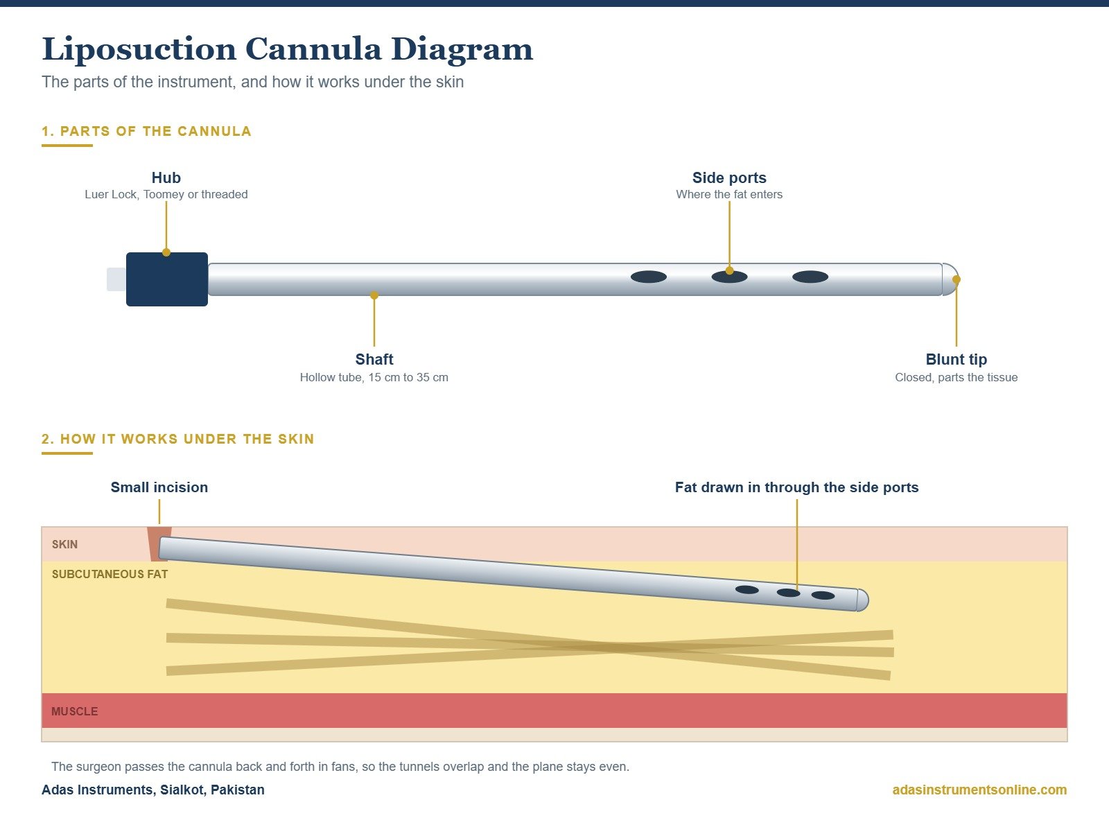 Liposuction cannula diagram showing the hub, shaft, side ports and blunt tip, and how the cannula works under the skin in the fat layer